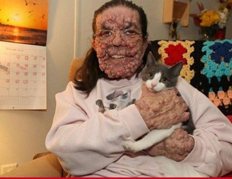 Dünyadaki en ilginç hastalıklar