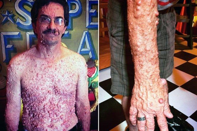 Dünyadaki en ilginç hastalıklar