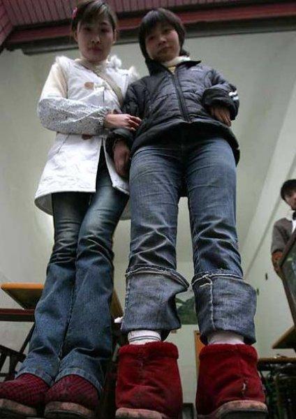 Dünyadaki en ilginç hastalıklar