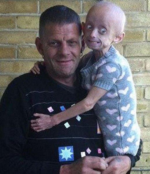 Dünyadaki en ilginç hastalıklar