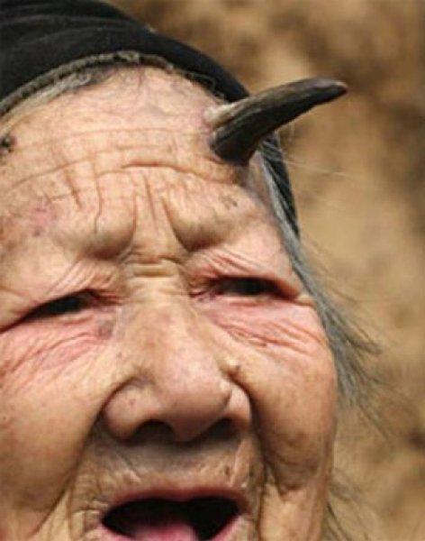 Dünyadaki en ilginç hastalıklar