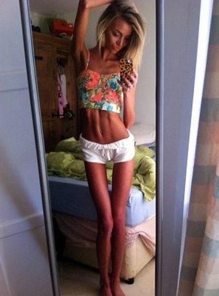 Dünyadaki en ilginç hastalıklar