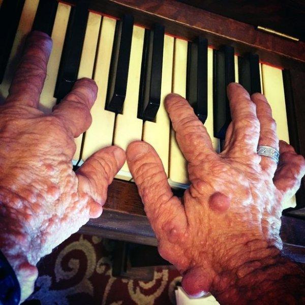 Dünyadaki en ilginç hastalıklar