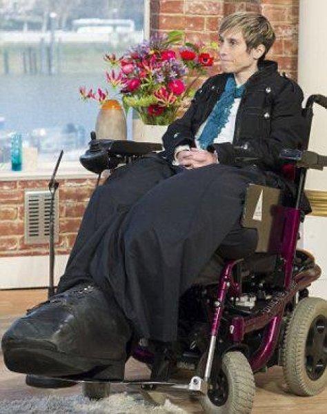 Dünyadaki en ilginç hastalıklar