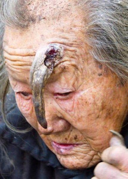 Dünyadaki en ilginç hastalıklar