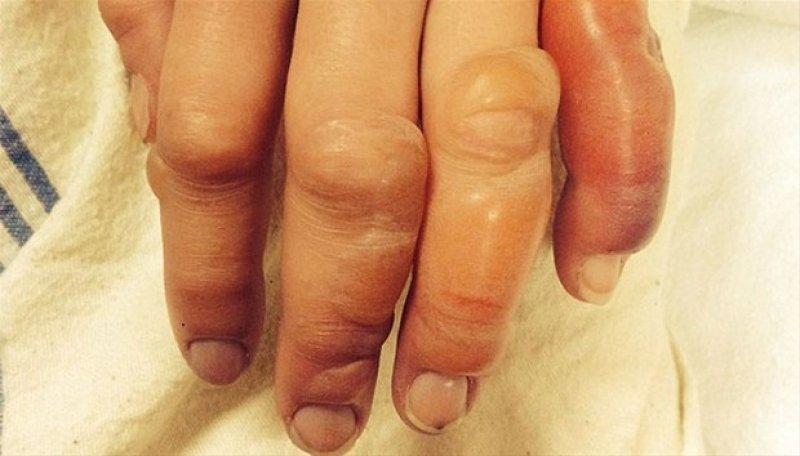 Dünyadaki en ilginç hastalıklar