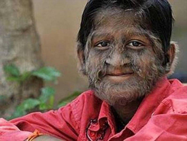 Dünyadaki en ilginç hastalıklar