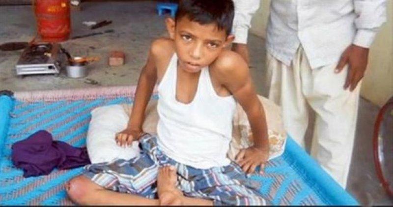 Dünyadaki en ilginç hastalıklar