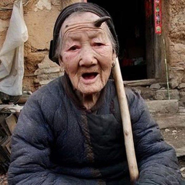 Dünyadaki en ilginç hastalıklar