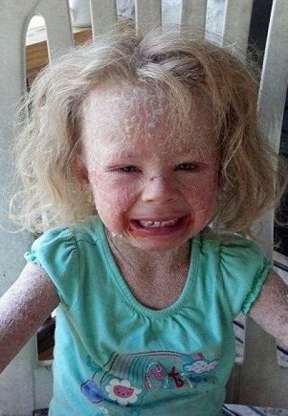 Dünyadaki en ilginç hastalıklar