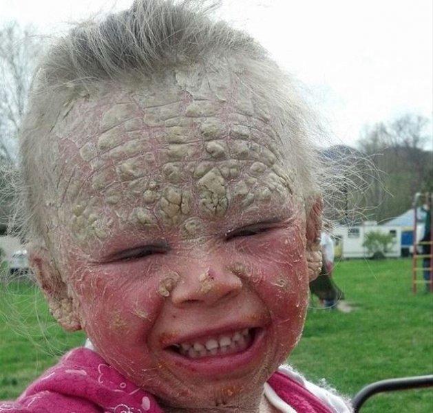 Dünyadaki en ilginç hastalıklar