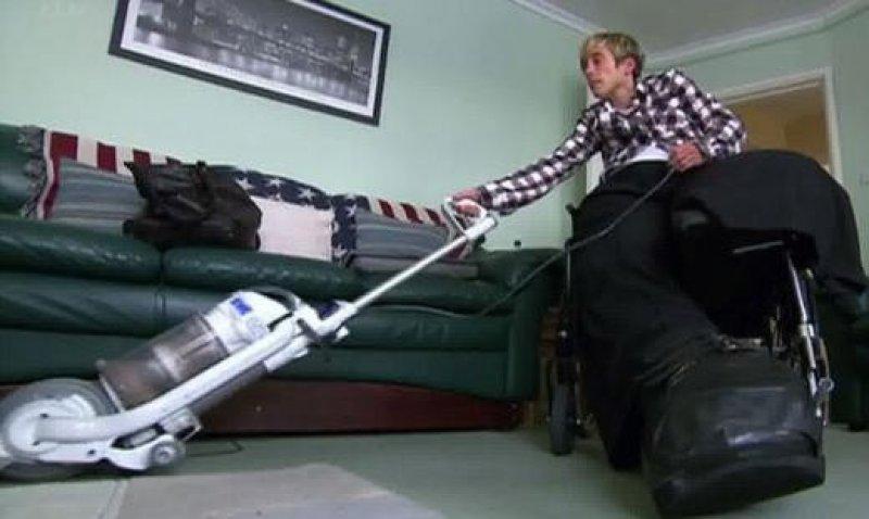 Dünyadaki en ilginç hastalıklar