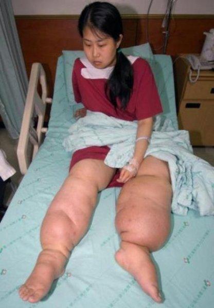 Dünyadaki en ilginç hastalıklar