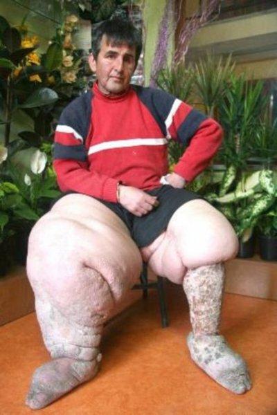 Dünyadaki en ilginç hastalıklar