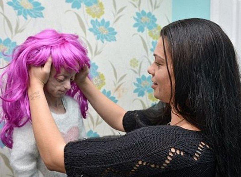 Dünyadaki en ilginç hastalıklar