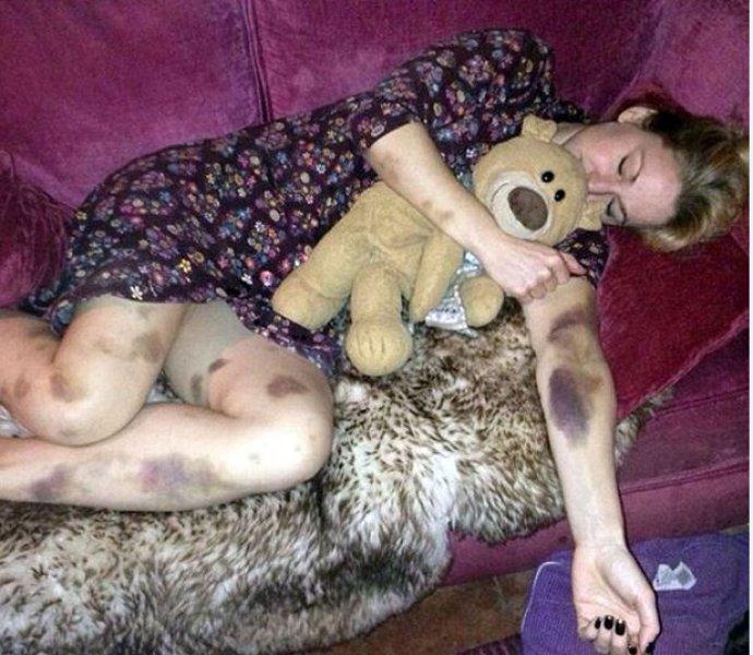 Dünyadaki en ilginç hastalıklar