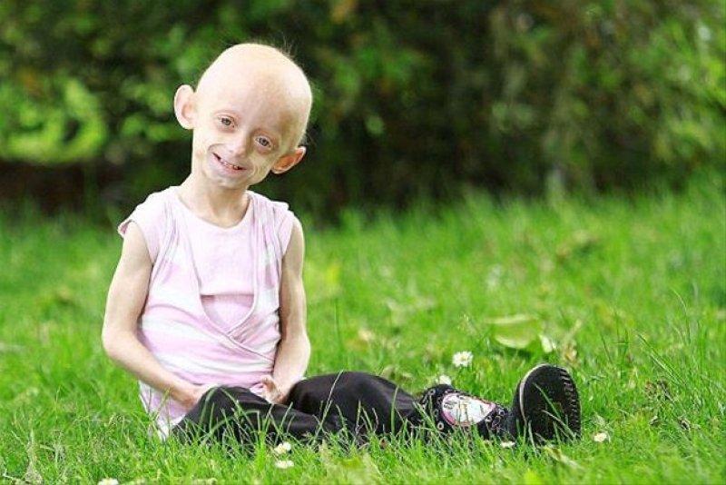 Dünyadaki en ilginç hastalıklar