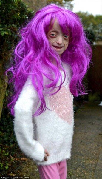 Dünyadaki en ilginç hastalıklar