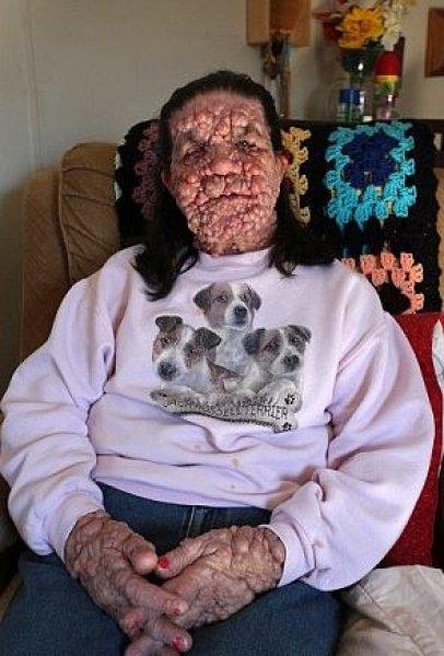 Dünyadaki en ilginç hastalıklar