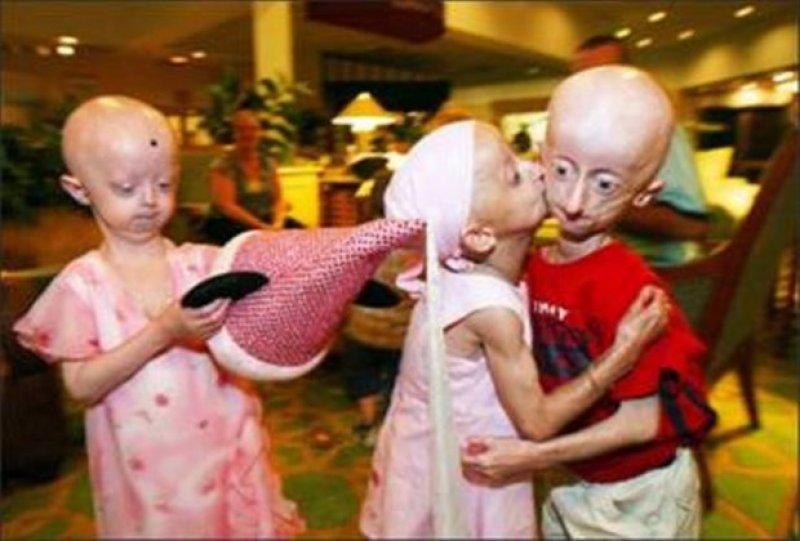 Dünyadaki en ilginç hastalıklar