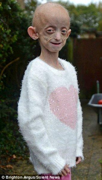 Dünyadaki en ilginç hastalıklar