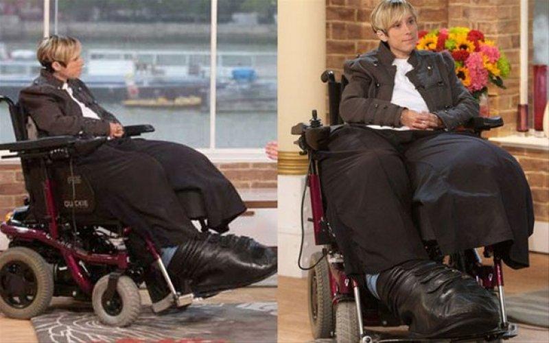 Dünyadaki en ilginç hastalıklar