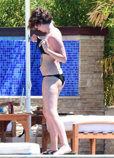 Farah Zeynep Abdullah güneşlenirken fena yakalandı