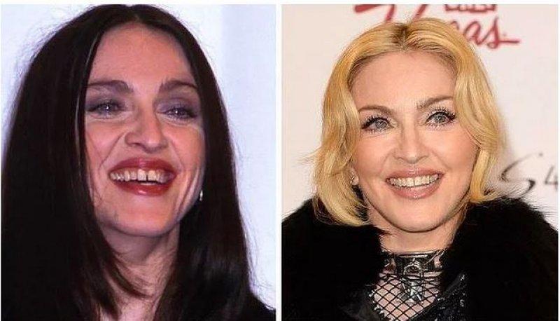 Ünlülerin değişen gülüşleri 