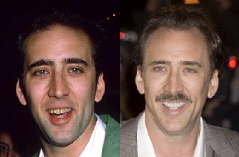 Ünlülerin değişen gülüşleri 