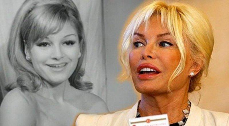 Ünlülerin değişen gülüşleri 