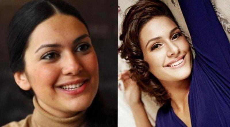 Ünlülerin değişen gülüşleri 