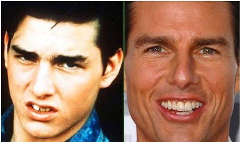 Ünlülerin değişen gülüşleri 