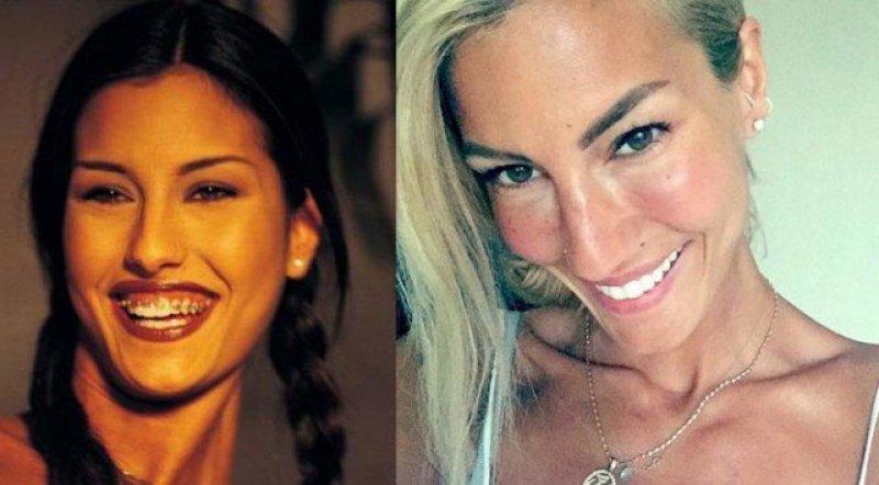 Ünlülerin değişen gülüşleri 