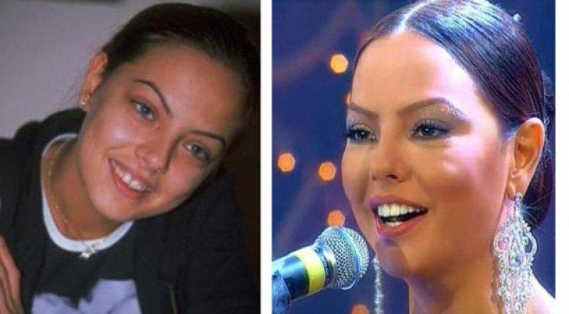 Ünlülerin değişen gülüşleri 