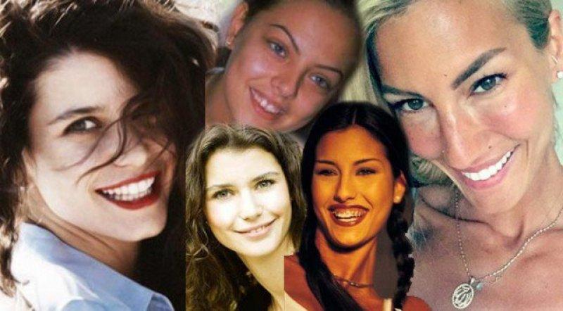 Ünlülerin değişen gülüşleri 