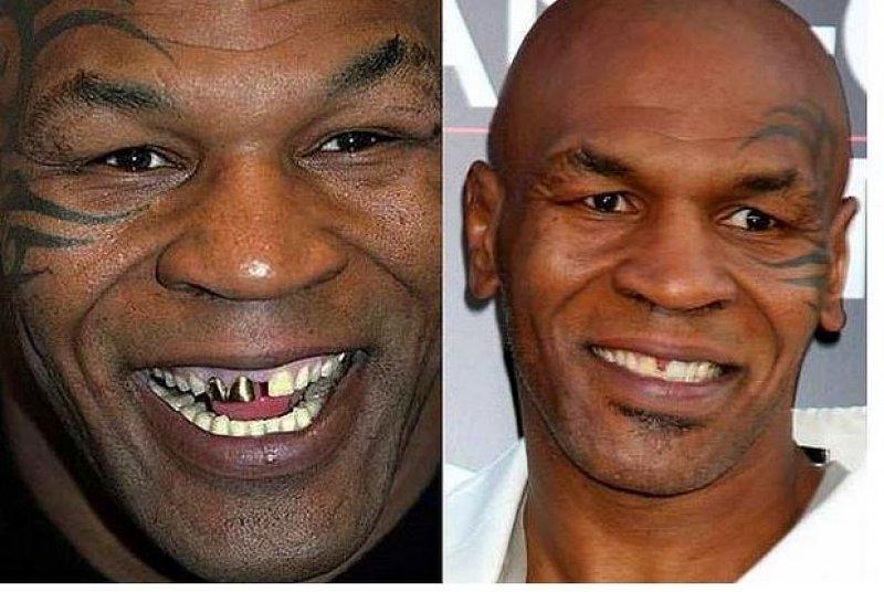 Ünlülerin değişen gülüşleri 