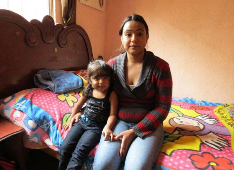 Hipertrikoz hastası aile belgesel oluyor 