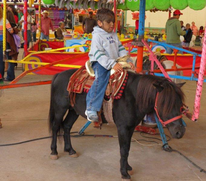 Hipertrikoz hastası aile belgesel oluyor 