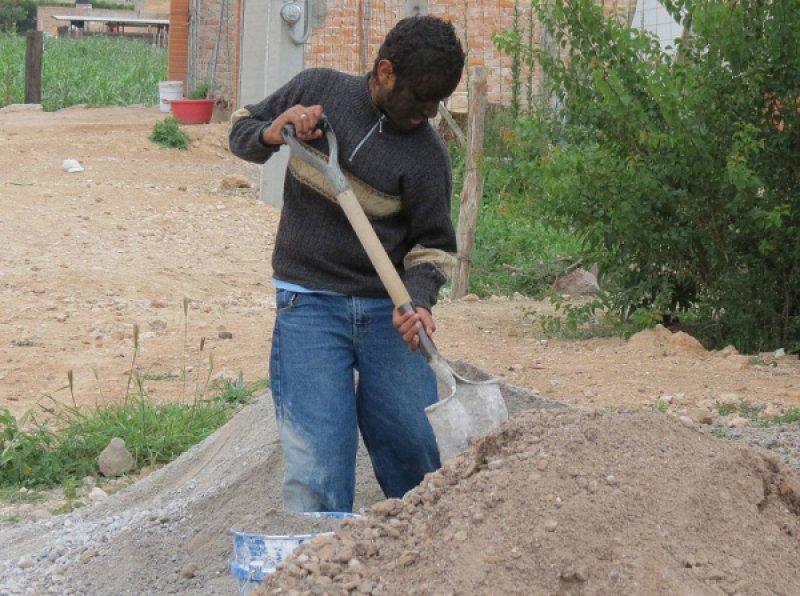 Hipertrikoz hastası aile belgesel oluyor 