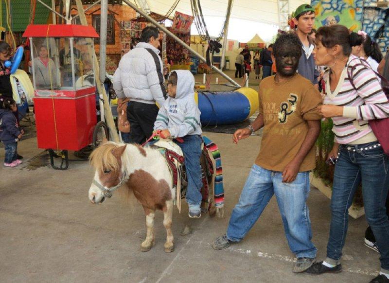 Hipertrikoz hastası aile belgesel oluyor 