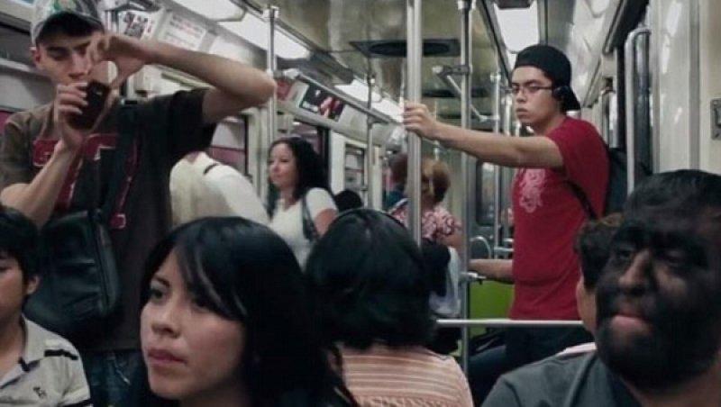 Hipertrikoz hastası aile belgesel oluyor 