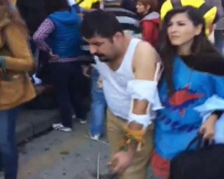 Ankara'daki patlamadan ilk görüntüler