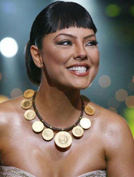 Ebru Gündeş: Botoks ve göğüs estetiğinden başka operasyon yaptırmadım