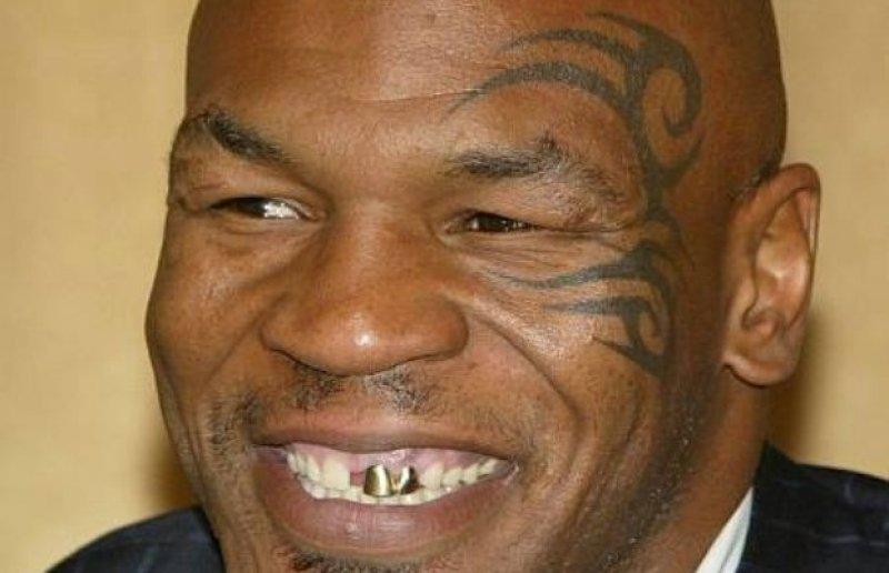 Gülümsemesini estetiğe borçlu ünlüler