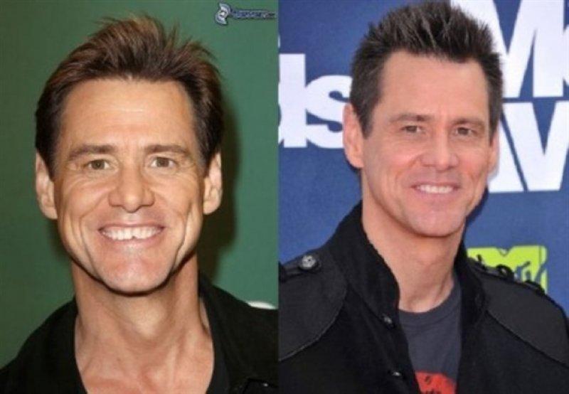 Gülümsemesini estetiğe borçlu ünlüler