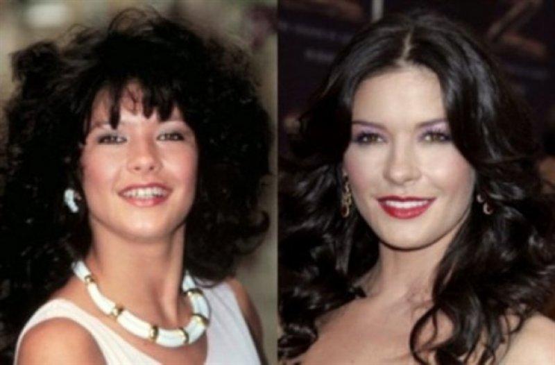 Gülümsemesini estetiğe borçlu ünlüler