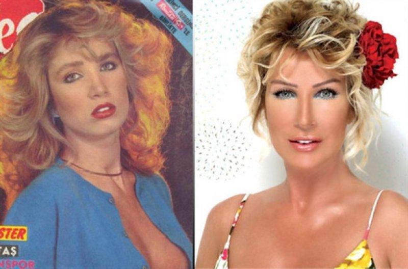 Gülümsemesini estetiğe borçlu ünlüler