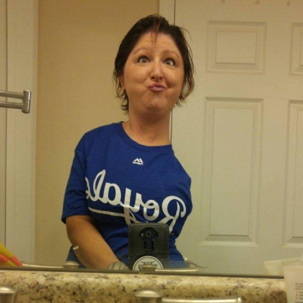 Ashley Kurpiel vücudunu kaybediyor  