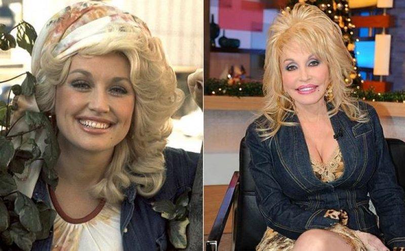 Estetik faciası ünlüler