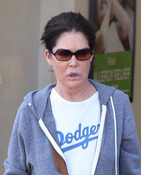 Estetik faciası ünlüler